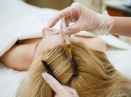 Плазмолифтинг волос, кожи головы