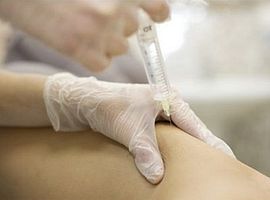 Плазмолифтинг тела